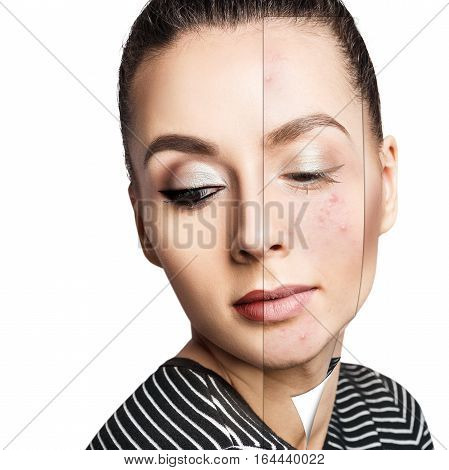 Layer with bad skin unstick from good healthy skin.