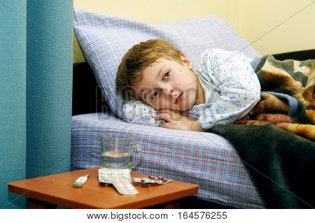 Sick child boy lying in bed with chicken pox