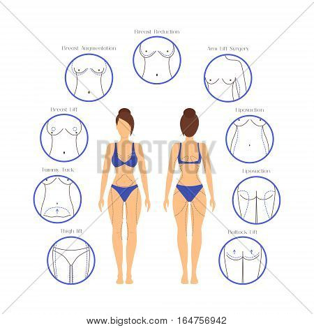 Plastic Surgery Woman Body Infographics for Posters and Brochures Liposuction Procedures Operation Correction. Vector illustration