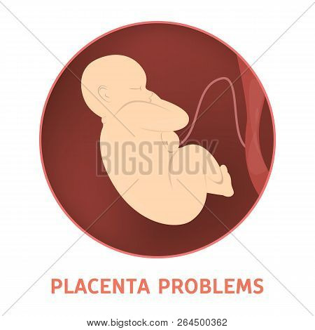 Medical Reasons For Cesarean Delivery Or C-section