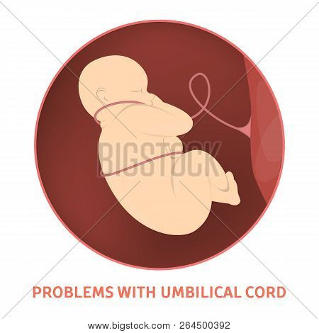 Medical Reasons For Cesarean Delivery Or C-section