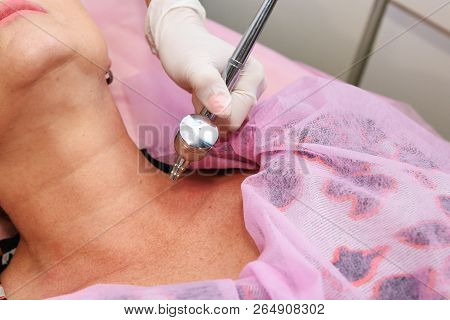 Oxygen Mesotherapy. Anti-aging Beauty Treatment Using Hyaluronic Acid.