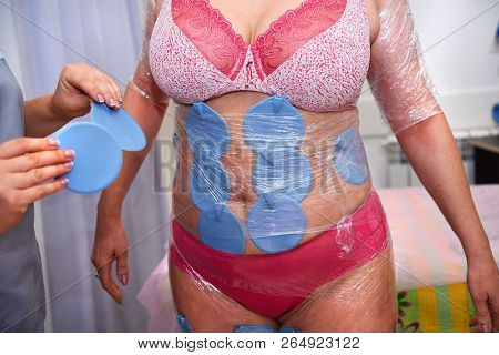 Myostimulation. Hardware Cosmetology. Body Care. Non Surgical Body Sculpting. Anti-cellulite And Ant