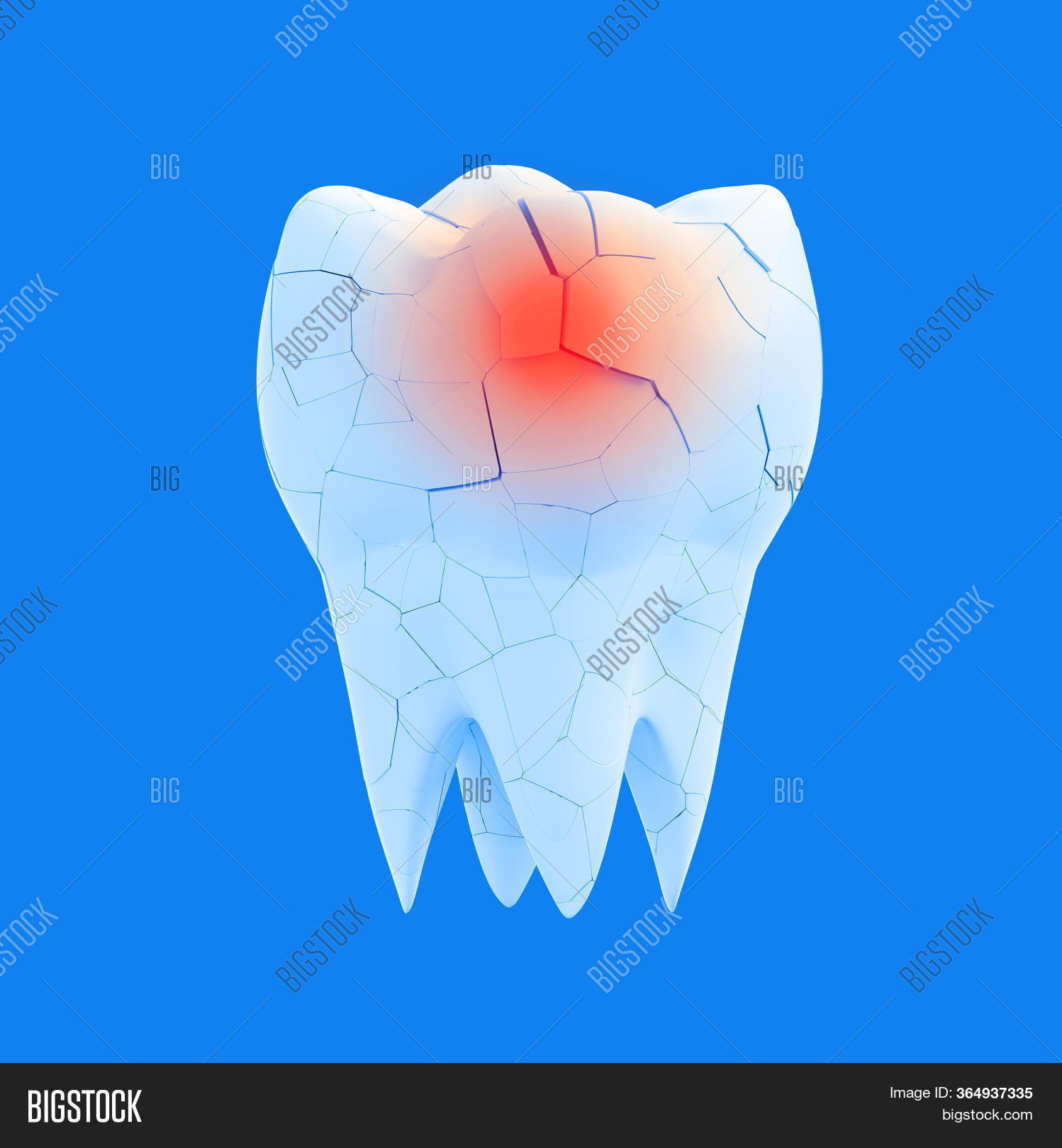 Broken Molar Tooth Red Image & Photo (Free Trial) | Bigstock