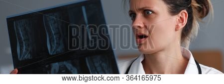 Portrait Of Experienced Surprised Pediatrician Holding Skiagram Of Unhealthy Person. Doctor Looking 