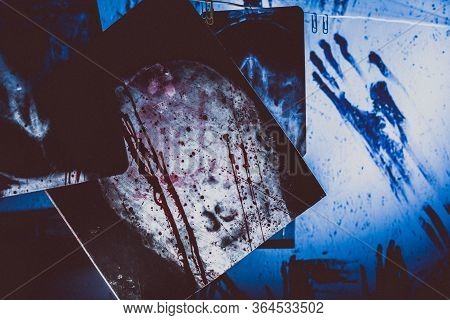 Bloody X-rays Hanging On A Rope In A Dark Room. Terrible Room Doctor Maniac Or Killer.