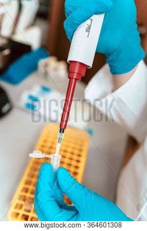 Close-up Photo Of Lab Technician Working With Micropipette And Samples. Blood Plasma As Coronavirus 