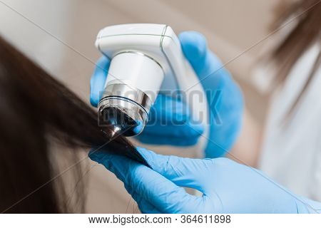 Trichoscopy Of Hair And Scalp Closeup. Trichoscope In The Hands Of A Doctor