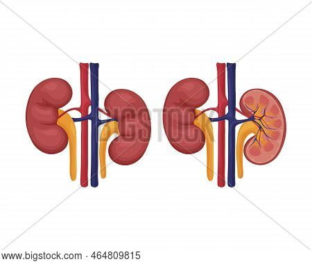 Human Kidneys. The Image Of Human Kidneys Whole And In Section. Internal Organs. Human Anatomy. Vect