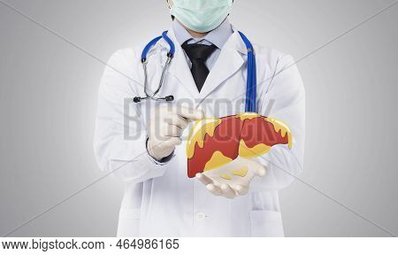 Doctor Showing Fatty Liver , Liver Disease In White Background