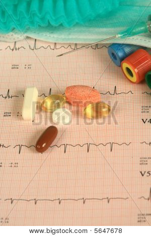 ELECTROCARDIOGRAMA