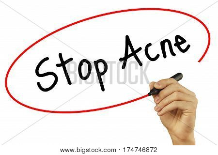 Man Hand Writing Stop Acne With Black Marker On Visual Screen. Isolated On Background. Business, Tec