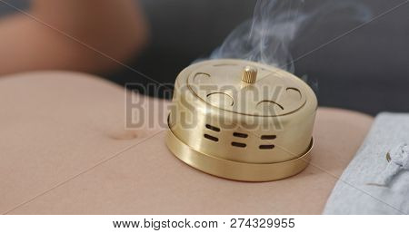 Chinese medicine moxibustion therapy 