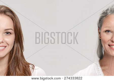 Comparison. Portrait Of Beautiful Woman With Problem And Clean Skin, Aging And Youth Concept, Beauty