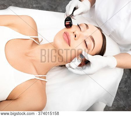 Beautician Doing Skin Treatment Using A Microneedle Derma Roller. Woman Getting Procedure Skincare, 