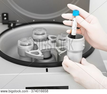 Plasmolifting Process . Preparation Of Blood For Injections. Cosmetologist Puts Tube Of Blood In Cen