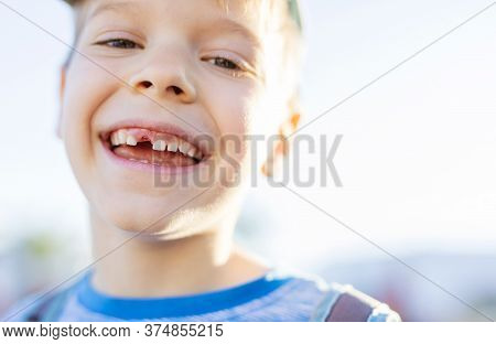 Closeup Of Happy Boy With Changing Theeth Outdoors