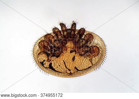 A Varroa Mite, Varroa Destructor, Under The Microscope. Varroa Mites Are Important And Dangerous Par
