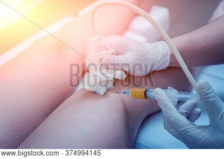 Ultrasound-guided Platelet-rich Plasma Injection Of The Knee.