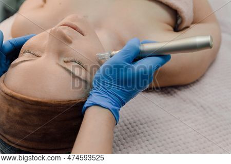 Nurse Hands Use Injection Dermapen Technology To Calm Woman Face, Patient Reclining On Couch In Spa,