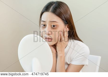 Bored, Insomnia Asian Young Woman, Girl Looking At Mirror, Without Makeup, Touch Under Eyes With Pro