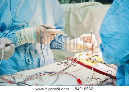 surgery operation. hands of surgeon with tool
