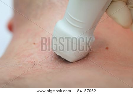 Ultrasonic test of male patient. Close-up photo