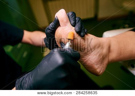 Podology, Treatment Of The Affected Areas Of The Feet, Medical Office, Pedicure