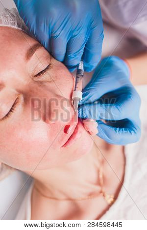 The Doctor Cosmetologist Makes Lip Augmentation Procedure Of A Beautiful Woman In A Beauty Salon.cos