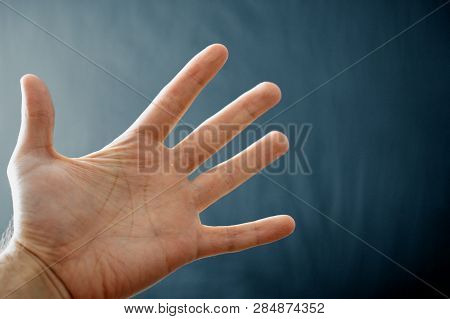 Adult Hand With Raynaud's Syndrome - Phenomenon. Close Up Hand With Fingers On Dark Background With 