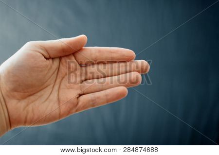Adult Hand With Raynaud's Syndrome - Phenomenon. Close Up Hand With Fingers On Dark Background With 