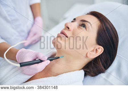 Cosmetician Using An Electrocautery Machine For Removing A Nevus