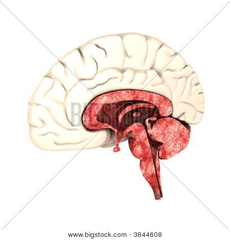 Half Brain