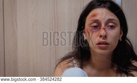 Beaten Woman Trembling With Fear Sitting In The Kitchen Desolated. Traumatised Helpless Terrified Vu