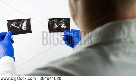 Ultrasound Of The Prostate Gland In The Hands Of A Doctor,to Make A Diagnosis, Close-up.demonstratio