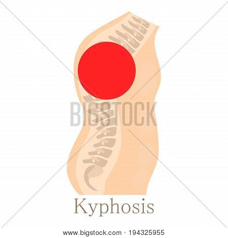 Kyphosis icon. Cartoon illustration of kyphosis vector icon for web isolated on white background