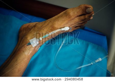 Patient With Saline Intravenous In The Hospital
