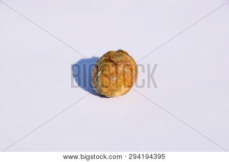 Stone Of The Gallbladder. The Result Of Gallstones. A Calculus Of Heterogeneous Composition.