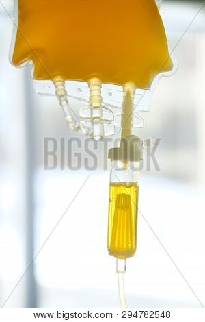 Transfusion Of Fresh Frozen Plazma (ffp), Bag On Stand