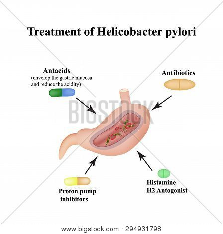 Treatment Of Helicobacter Pylori. Medications. Antacids, Proton Pump Blockers And H2-histamine Block