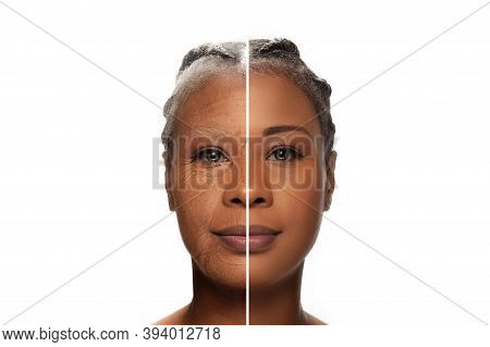 Comparison. Portrait Of Beautiful African Woman With Problem And Clean Skin, Aging And Youth Concept