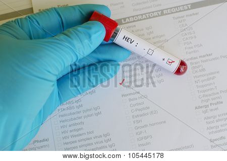 Hepatitis E virus (HEV)