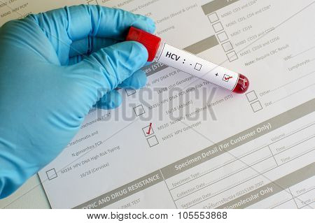 Hepatitis C virus (HCV)