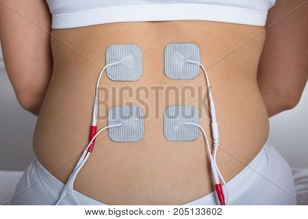 Close-up Of A Woman With Electrostimulator Electrodes On Her Back