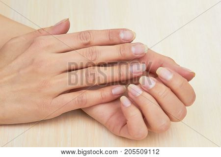 Female hands without varnish on nails. Young woman clean hands close up. Woman gentle hands with clean natural nails.