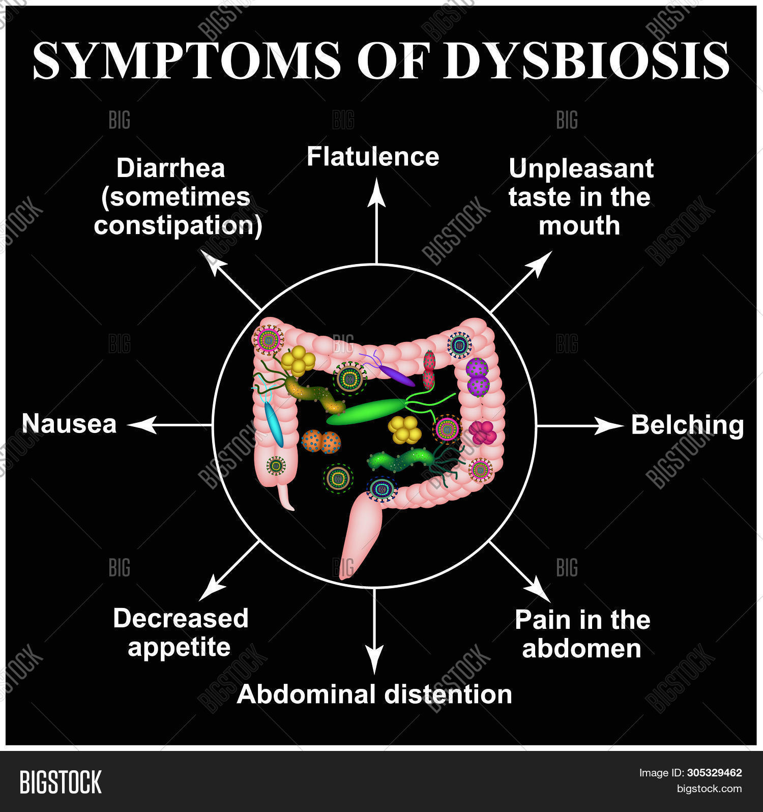 Symptoms Dysbiosis. Image & Photo (Free Trial) Bigstock