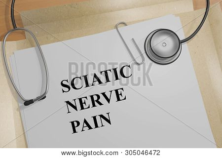 3d Illustration Of Sciatic Nerve Pain Title On A Medical Document