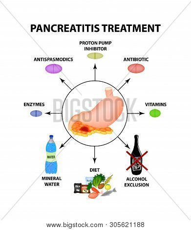 Pancreatitis Treatment. The Structure Of The Stomach And Pancreas. Infographics. Illustration On Iso