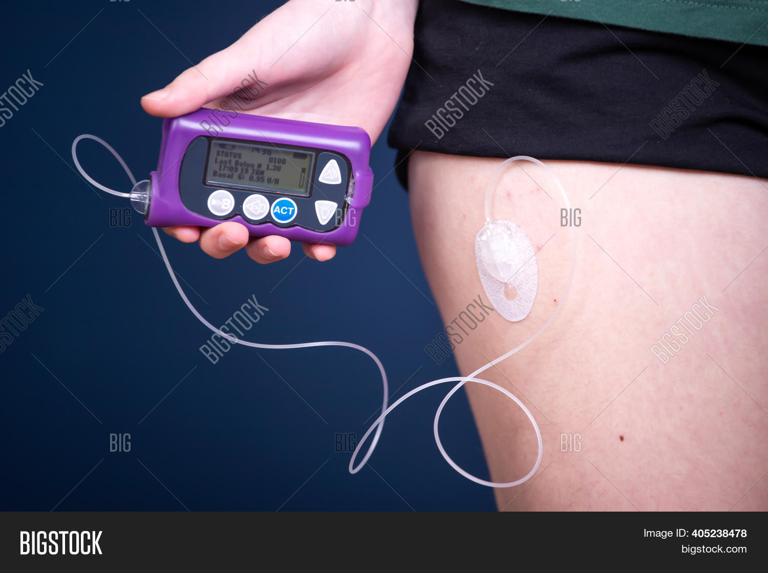Close View Diabetic Image & Photo (Free Trial) Bigstock