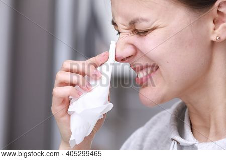 Herpes On The Nose - Pretty Young Woman Feels Discomfort Of Herpes On Her Face And Holds A Handkerch
